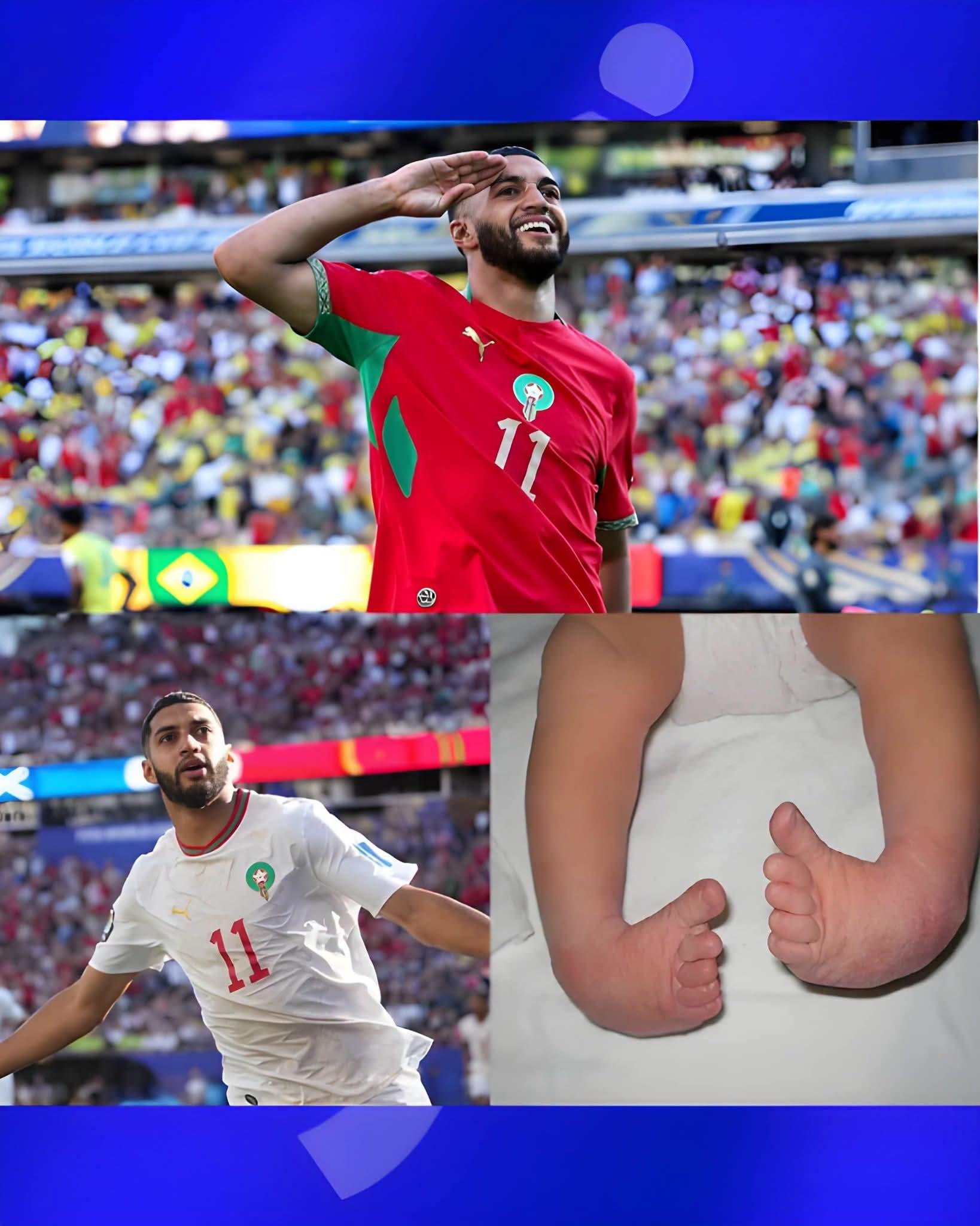 معانات الصيبارى بعمر السنتين